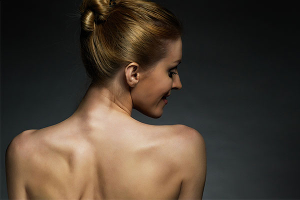 Back of Woman's & Shoulders After Mohr's Surgery