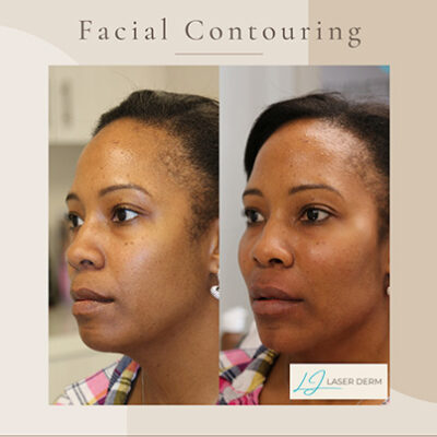 facial-balancing-1 facial-balancing-1