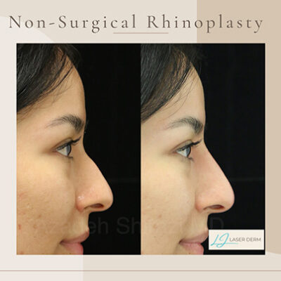 facial-balancing-2 facial-balancing-2