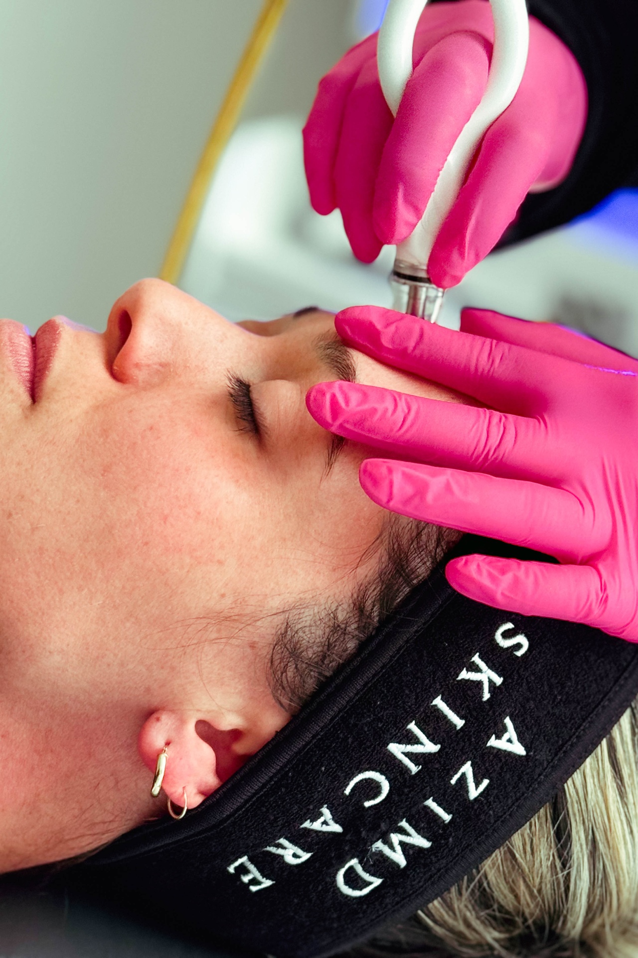 DiamondGlow treatment at La Jolla Laser Derm
